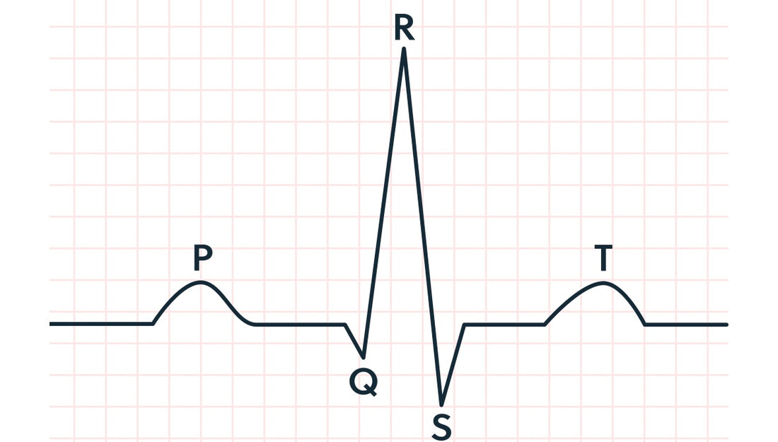 Renting an ECG device vs buying