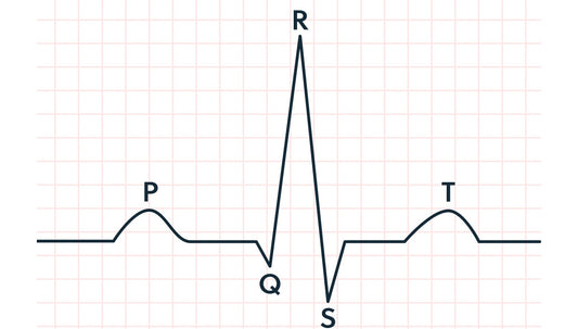 Renting an ECG device vs buying