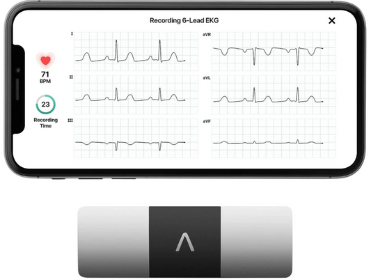6-lead ECG device