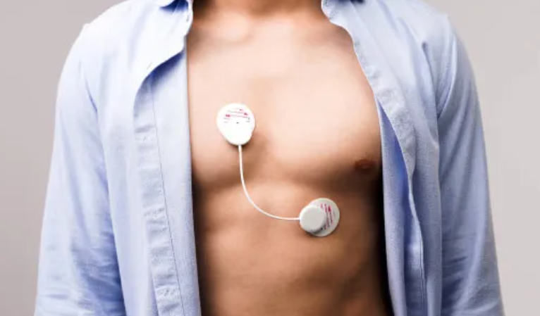 Holter monitor